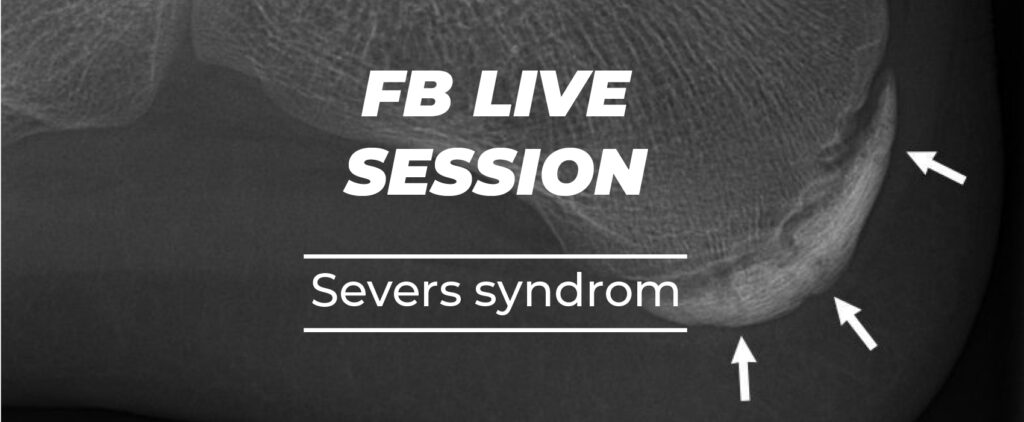 Livesession